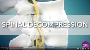 Spinal Decompression in Vacaville CA